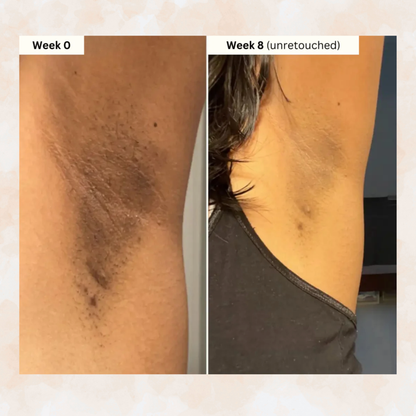 Jabón Cúrcuma Limón: Piel Radiante, Limpieza Profunda, Aclara Manchas