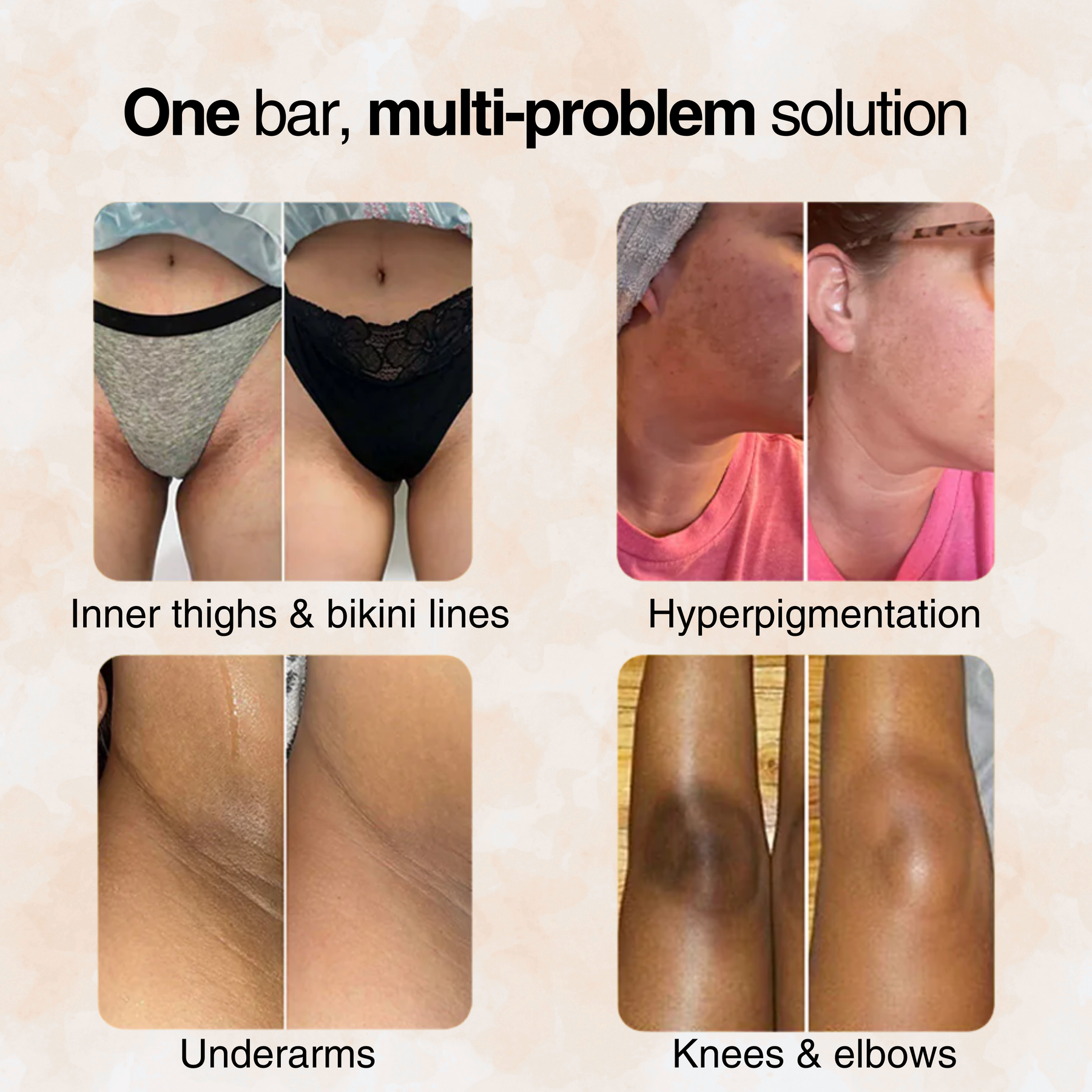 Jabón Cúrcuma Limón: Piel Radiante, Limpieza Profunda, Aclara Manchas