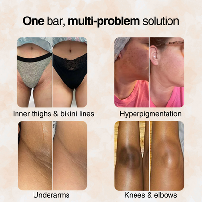 Jabón Cúrcuma Limón: Piel Radiante, Limpieza Profunda, Aclara Manchas