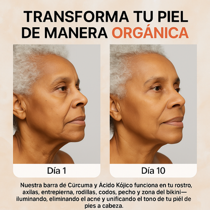 Jabón Cúrcuma Limón: Piel Radiante, Limpieza Profunda, Aclara Manchas