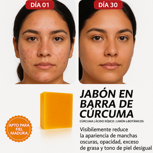 Jabón Cúrcuma Limón: Piel Radiante, Limpieza Profunda, Aclara Manchas
