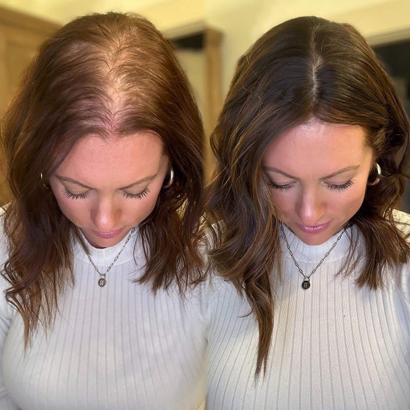 HAIR GROWTH- Comienza Tu Transformación Capilar